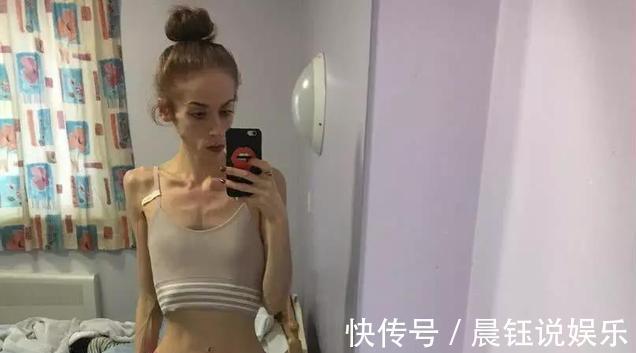 减肥法|女孩为减肥染上厌食症,为当伴娘增肥40斤,出现的时候惊艳全场