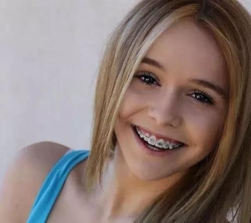 双眼皮|哪些情况才适合整容?做好这3件事还是很丑,那整容也无可厚非