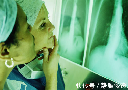 食物|肺癌晚期病人,最忌讳吃什么?吃肺癌靶向药真的能活很久?