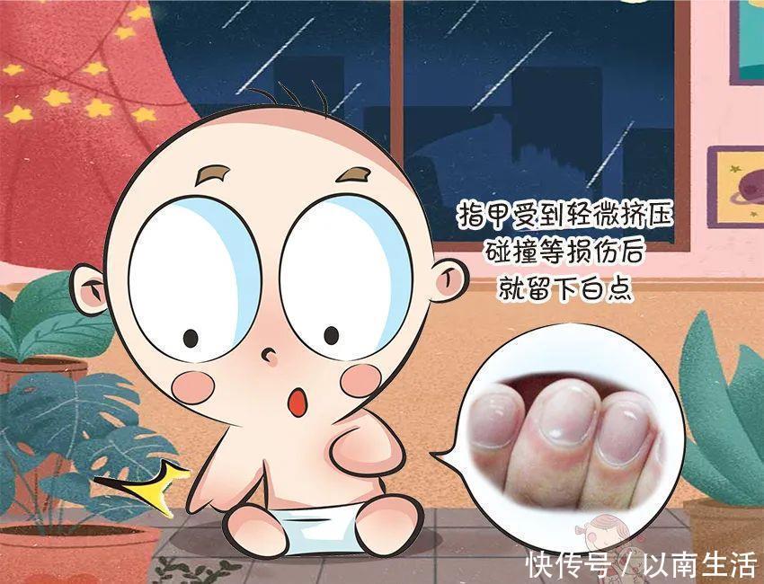 爸妈|倒刺、白斑,这还是宝宝的小指甲吗?要紧吗?宝宝指甲问题大汇总