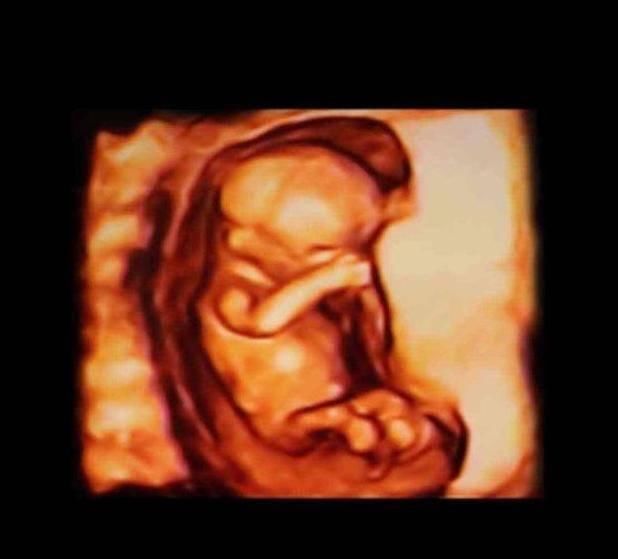 性别|胎儿从卵泡到性别形成,17张图片清晰诠释,男宝女宝看得很清楚