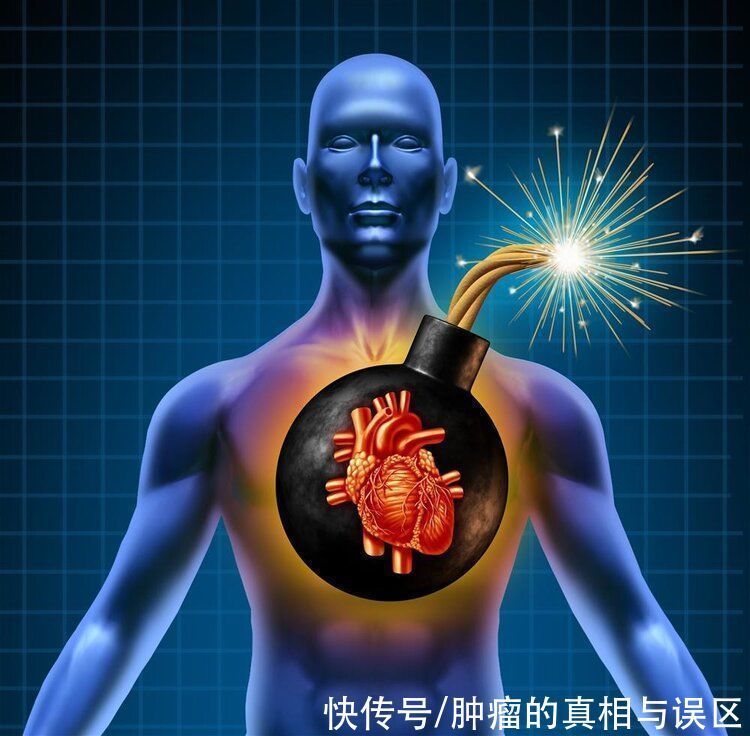 治疗|放疗会让人死得更快?其实它是治癌的“火箭弹”,你误解它太深了