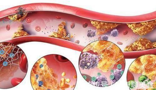 血管堵塞|血管最怕堵,饭后常做这3个小动作,血管将永远畅通无阻