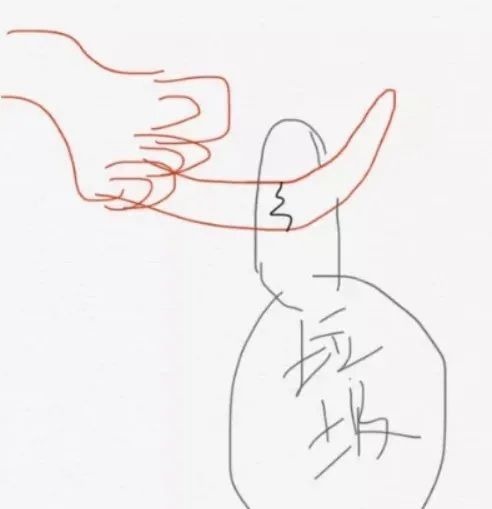 垃圾|女子扔个垃圾,手指断了要手术!这个习惯很多人也有