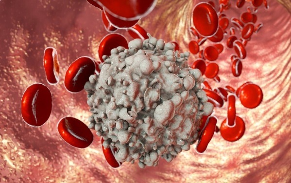 癌症|有毒又致癌的砒霜,也是抗癌良药科学家发现砒霜抗癌新机制