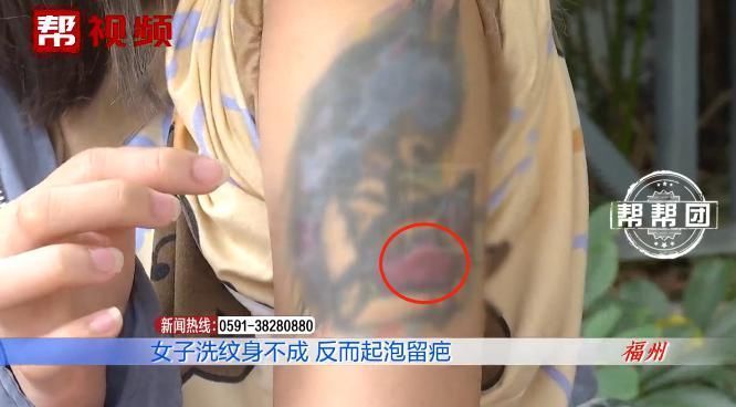 皮肤起泡化脓留疤,医生提醒,做这事得谨慎!