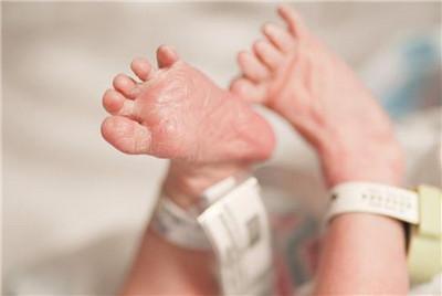 准妈妈|14年过去,原本身体巴掌大“世界最小宝宝”,如今颜值高到认不出