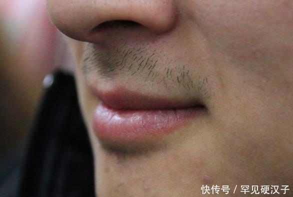 醒来|睡到半夜突然醒来,嘴巴又干又苦,6种疾病或许是“罪魁祸首”