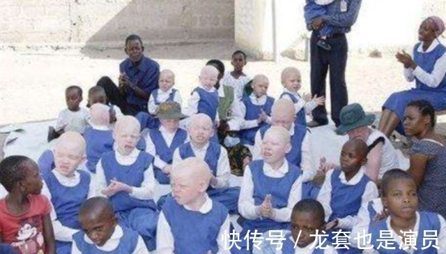 病人@非洲版“唐僧”:皮肤全白,血液比黄金还贵,死后遗骸能卖上百万
