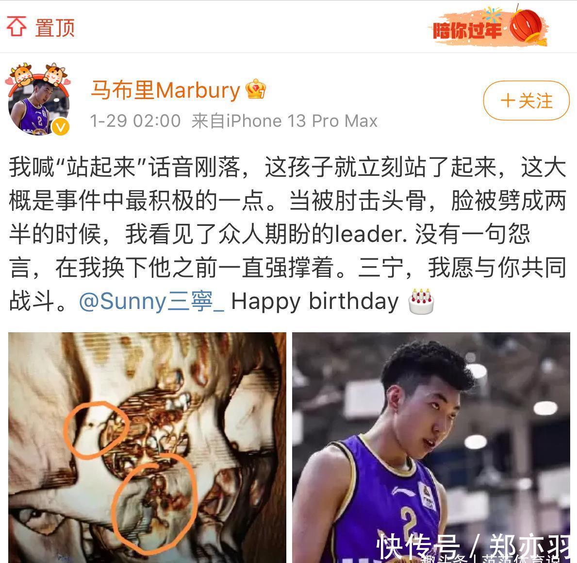 广厦|砸人饭碗!北控新星遭肘击头部出现5处伤病,大V力挺,马布里怒了