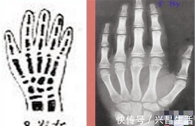 小矮个|女生初潮来临后会停止长个?不要早于此年龄,否则多半是小矮个