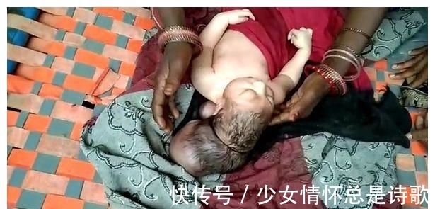 女子|印度女子产下“3头婴儿”,当地人认为是“上帝的化身”