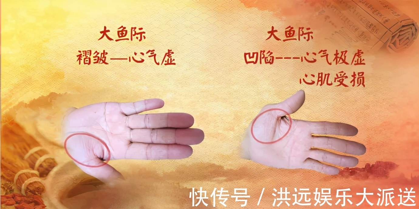 慢性心衰|身体好不好,看手就知道!这几处变化可能藏大病