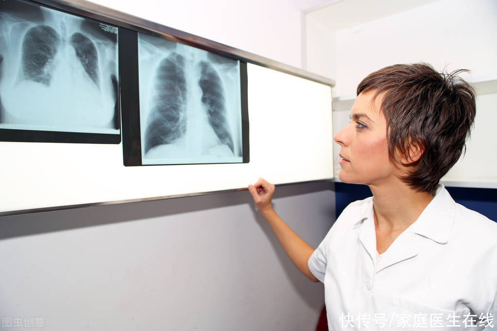 “心肺血管领域的癌症”——肺动脉高压有多可怕？专家带你了解它|中医在身边 | 专家