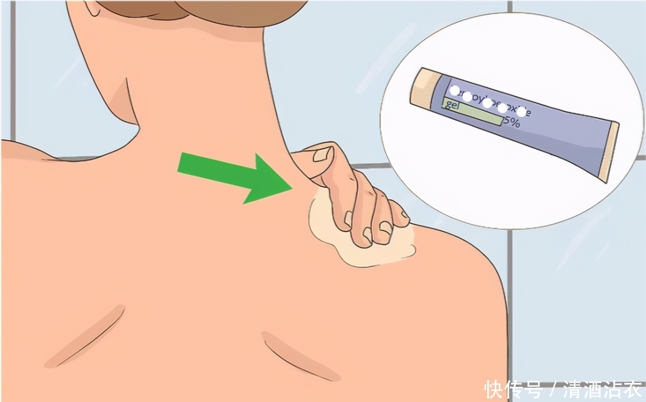 一个人时如何搓背?利用锅铲子只需三步,就能拥有一个牛奶背