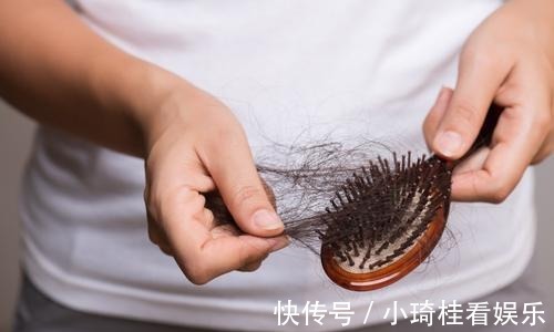 秘密|关于头发的小秘密你知道多少?脱发和正常掉发的区别在哪里呢?