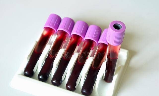 尿毒症|糖尿病肾病，肌酐397只能等透析？抓最后机会，还需重视这两项