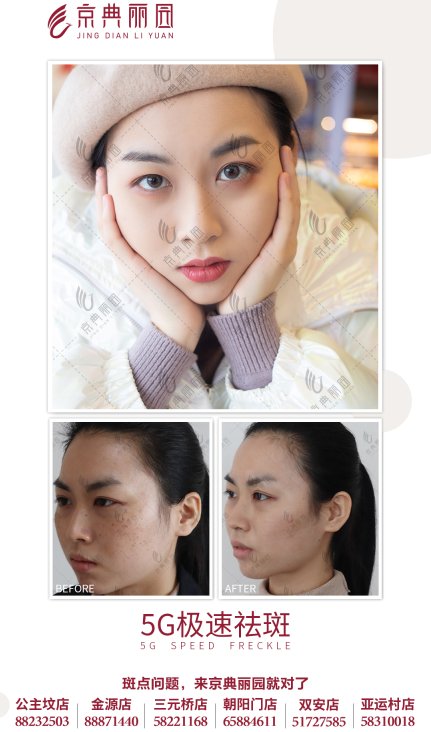 新广告法|京典丽园认为：分型有序改善才能告别色斑