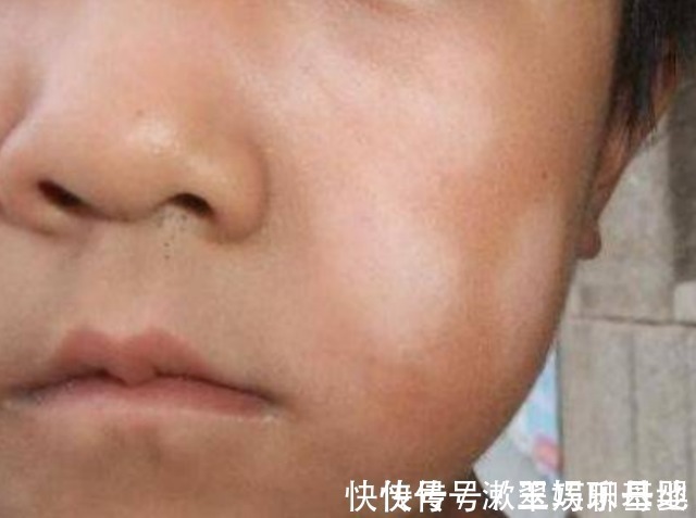 人体|孩子有这6大症状,表明肚子里长了“蛔虫”,家长们要重视起来!