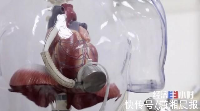 人工心脏|山东首例人工心脏植入患者出院，需每天充电