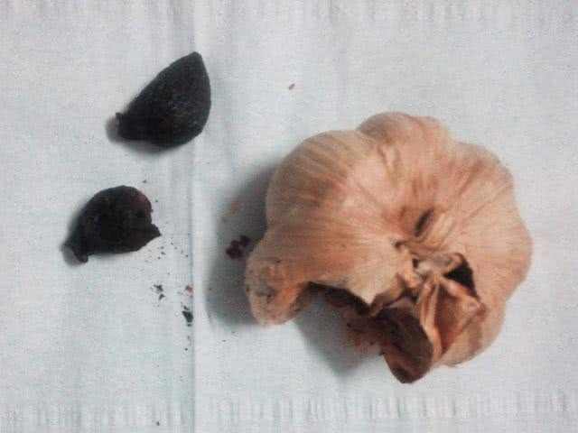 杨桃|子宫肌瘤“克星”来了，女性常吃点，排毒化瘀，子宫更健康