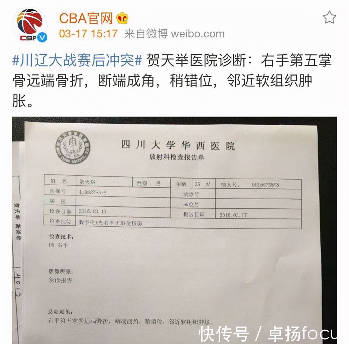 郭艾伦|揭秘2016年辽川球迷重大冲突！郭艾伦母亲大喊“儿子快跑”！