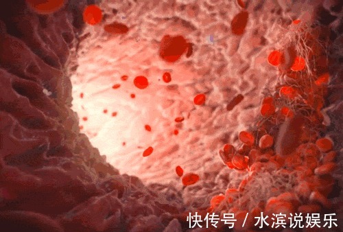 心血管疾病|黄芪加它，九月开始喝，活血化瘀护心脏！老中医每天一杯