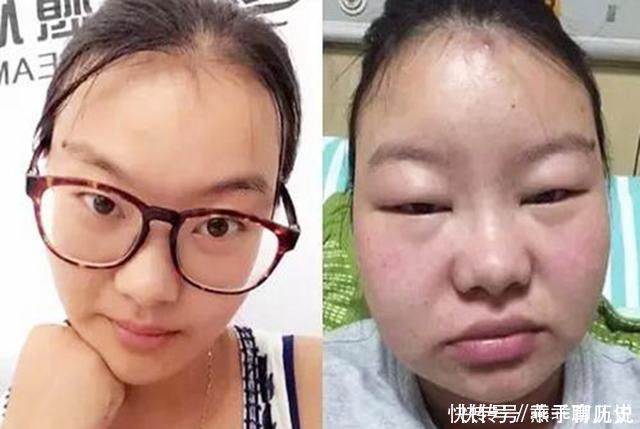 月子|一组女性生娃前后“对比图”火了，隐藏了妊娠纹，差距也显而易见