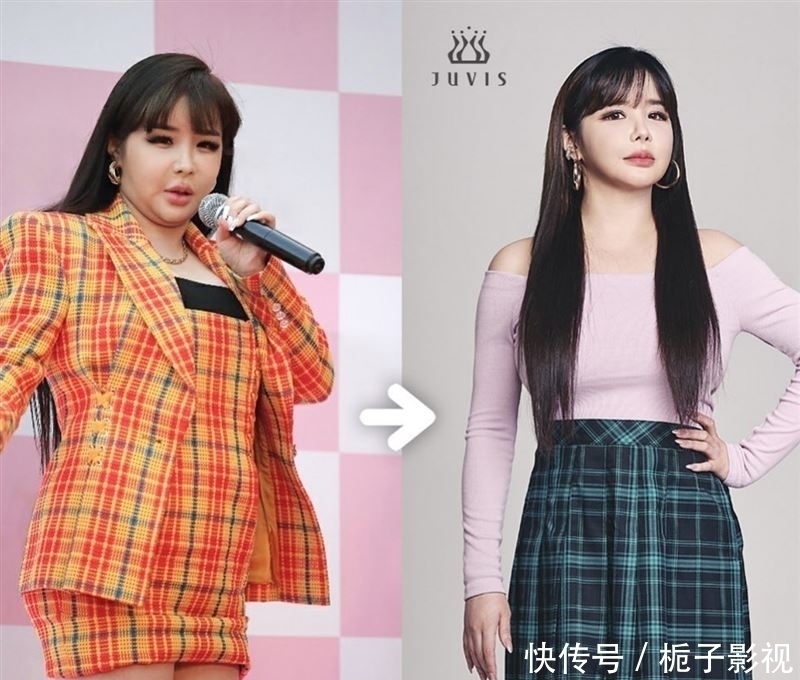 菜单|暴肥到惨不忍睹！朴春甩肉11公斤　曝超可怕「减肥菜单」