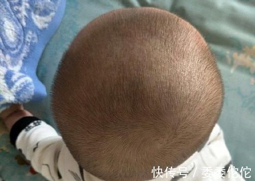 婴儿|婴儿头型形成的3个关键期，家长把握好及时纠正，错过就来不及了