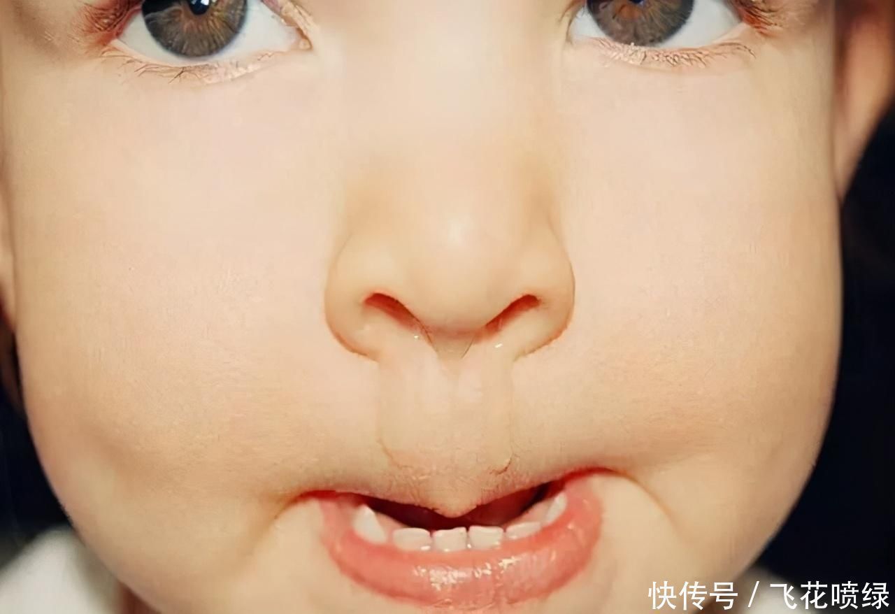 健康状况|从鼻涕看健康状况孩子出现这4种症状,家长应及时带他去医院
