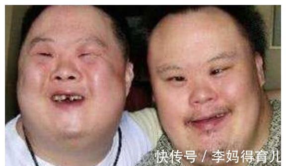 高龄产妇|怀孕期间若有4种情况之一,生出唐氏儿,希望你一个也没有