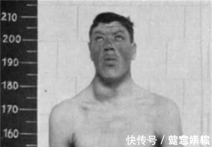 侏儒|雷纳尔:前半生是1米22的侏儒,后半生是2米16的巨人,他经历了啥