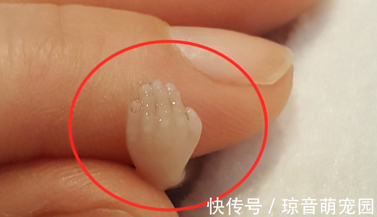 大喜大悲|年轻孕妈意外流产,看到胎儿手脚成型模样后泪崩:妈妈对不起你