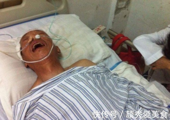 医生|60岁大爷深夜脑出血,医生直言:都这个年纪了,还不懂节制!