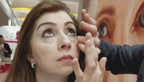 科普篇|眼袋脂肪手术后为什么易复发?丨科普篇