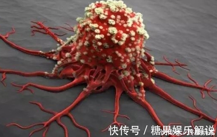 复发|肿瘤手术后复发的几率是多少?做好4件事,或许有助降低复发率