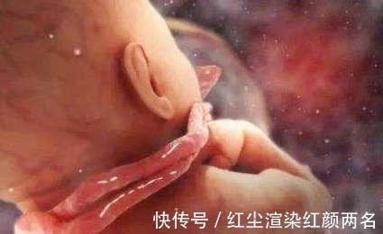 胎儿|孕妇若有4个习惯,容易导致脐带绕颈,怀孕后要及时改掉