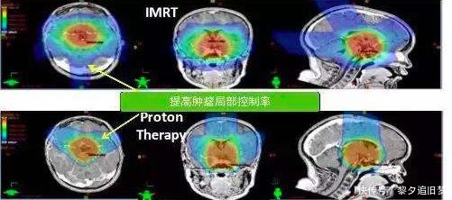 他把头伸进了粒子加速器,直接被接近光速的