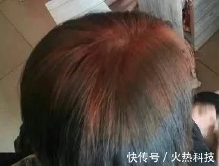 染发剂 千万不要自己在家染发别怪没提醒你,否则后悔都来不及了