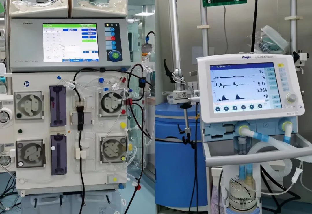 icu|极度危重，女子这样喝酒，醒来发现自己在医院