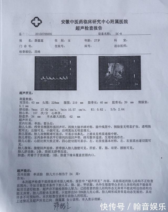 误区|孕期要做四维彩超,四维彩超的这些误区和认识,孕妈妈早知道早好