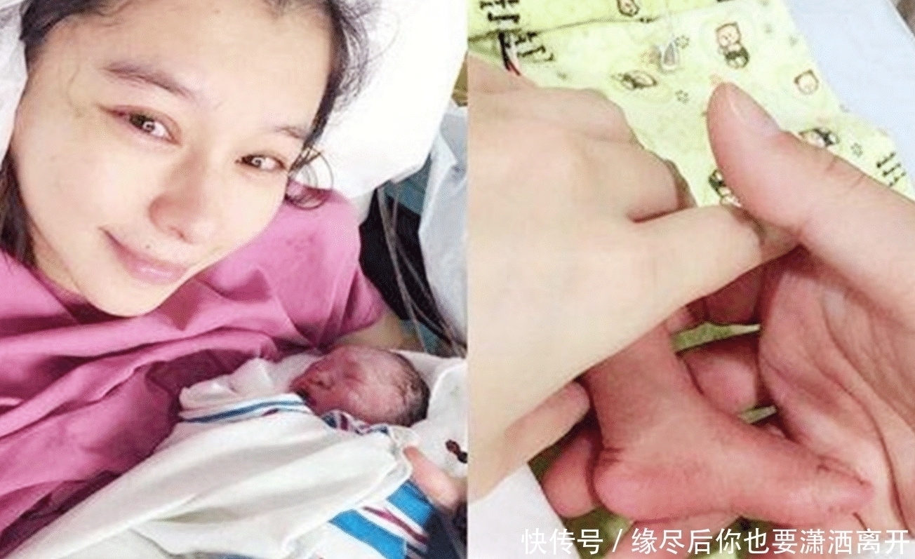 剖腹产|为什么女明星宁愿在肚子上“挨刀”，也不愿顺产生娃？情有可原