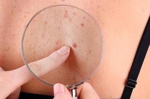 油腻食物|实不相瞒!身体出现4个表现,或是肝硬化前兆,早治疗早好