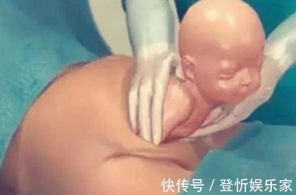 伤口|剖腹产只是“挨一刀”就完事看完手术全过程,忍不住心疼女人