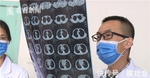 支气管|82岁老太肺功能丧失三分之二!竟和这个习惯有关