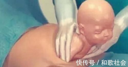 子宫|剖腹产只是“挨一刀”就完事?看完手术全过程,忍不住心疼女人