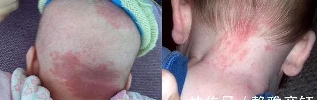 护士|发现新生儿小屁屁上有“淤青”,老公想找护士理论,最后暗暗庆幸