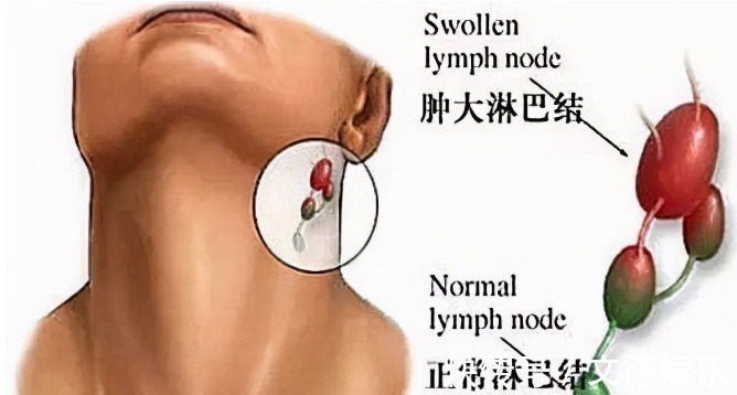 梗阻感|癌症靠近时,身体会如何呼救关键时刻,要读懂身体的求救信号