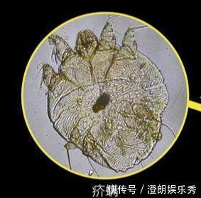 除螨|你可能已被“寄生虫”包围，有的在你脸上打洞，还有的住在毛囊里